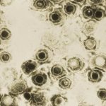 Herpes virus appears to hijack immune cells in the brain and could have serious consequences