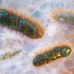 Sexually transmitted stomach bug spreads