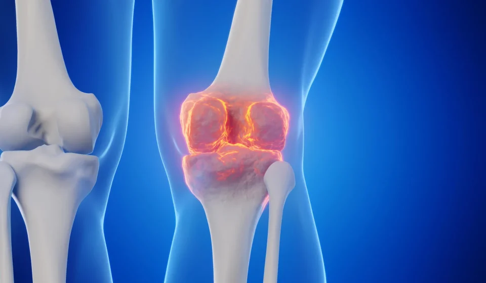 Goodbye joint replacements? Stanford scientists have found a way to regrow cartilage and stop arthritis Goodbye joint replacements? Stanford scientists have found a way to regrow cartilage and stop arthritis