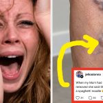 "When my mom had her varicose veins removed, she said they ripped them out like spaghetti noodles 😩": People are sharing crazy things about the human body that most people don't know, and they're so disturbing they're going viral - BuzzFeed
