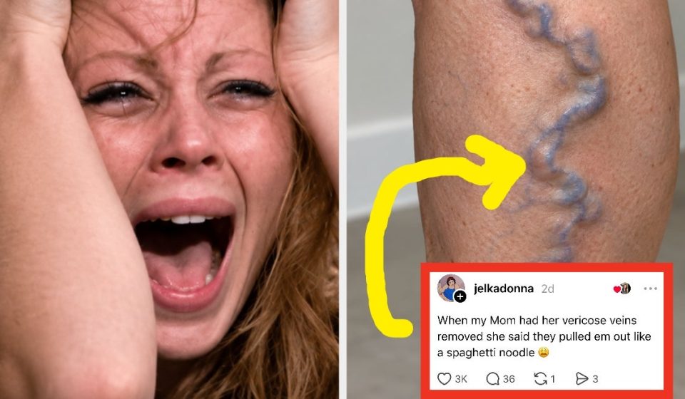 "When my mom had her varicose veins removed, she said they ripped them out like spaghetti noodles 😩": People are sharing crazy things about the human body that most people don't know, and they're so disturbing they're going viral - BuzzFeed
