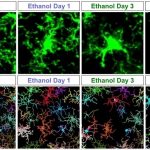 Alcohol doesn't just affect neurons: It triggers immune cells to destroy the brain's structural matrix, mouse study finds: ScienceAlert