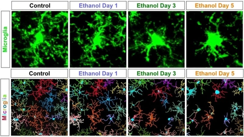 Alcohol doesn't just affect neurons: It triggers immune cells to destroy the brain's structural matrix, mouse study finds: ScienceAlert