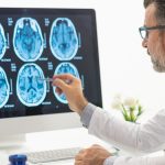 Ultra-processed foods linked to stroke and brain damage, study finds
