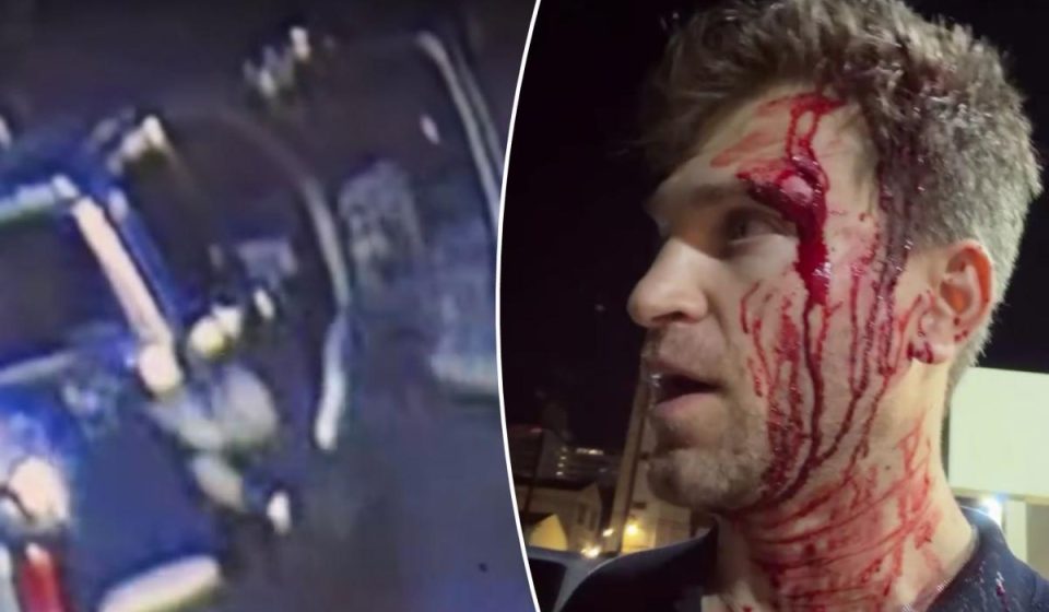 “Pretty Little Liars” star Keegan Allen was robbed at gunpoint and knife during an attack outside a luxury grocery store in Hollywood.