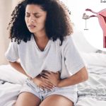What are the lesser known symptoms of endometriosis