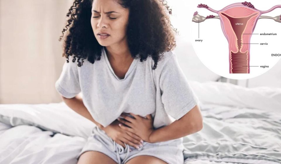 What are the lesser known symptoms of endometriosis