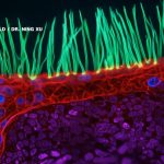 Competition-winning microscope video is full of AI confabulation, scientists say