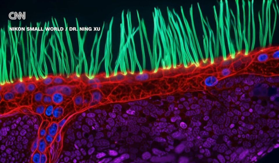 Competition-winning microscope video is full of AI confabulation, scientists say