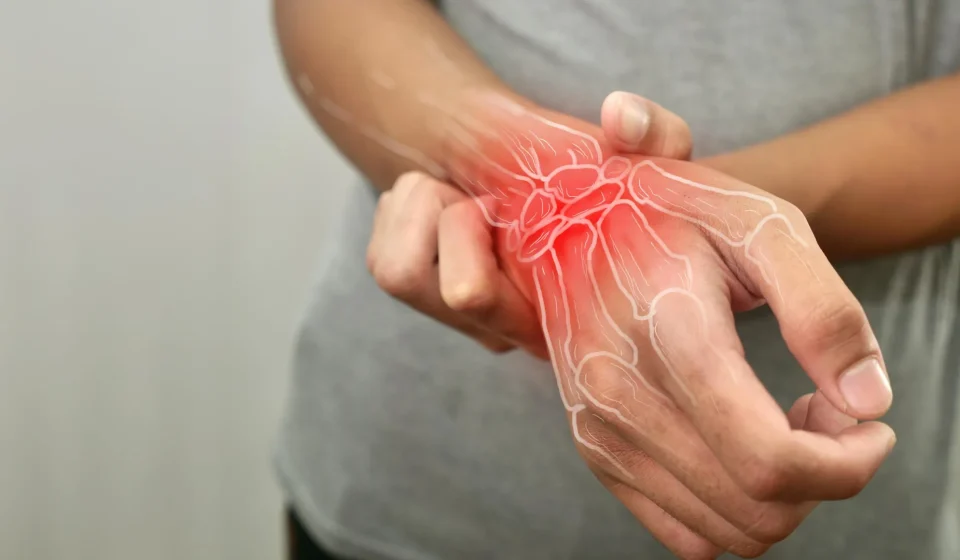Natural compound could fight rheumatoid arthritis at its source