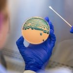 Shigella antibiotic resistance increases as drug-resistant strains grow