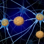 Scientists may have overlooked a hidden Alzheimer's culprit for decades