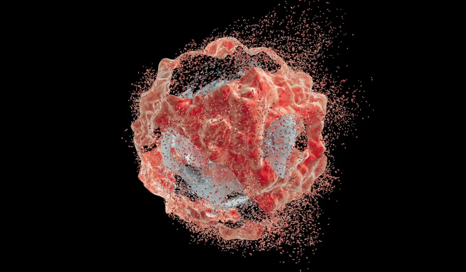 Bowel cancer “melted” after immunotherapy, then stayed away