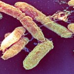 What is pneumonic plague? : NPR