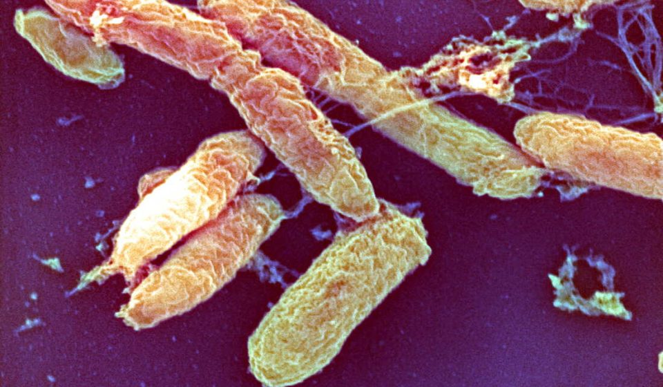 What is pneumonic plague? : NPR