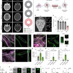 Osteoclasts intercept meningeal lymphatic pathways for dural metastases